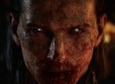 Even After Just A Few Days, The Blood Of Dawnwalker Has Its Teeth In Me